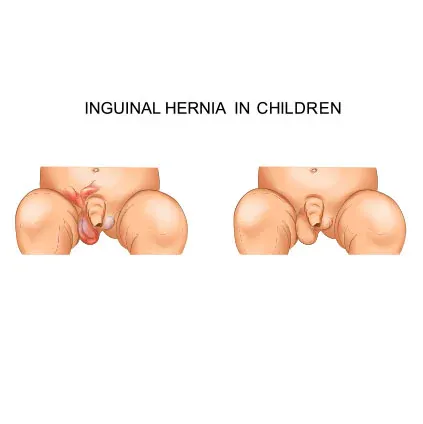  درمان کوچک بودن اندام تناسلی نوجوانان