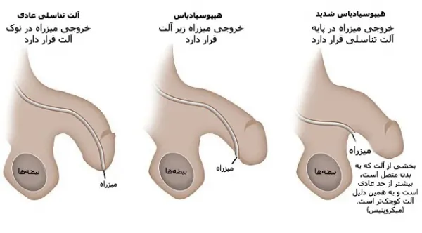  درمان کوچک بودن اندام تناسلی نوجوانان