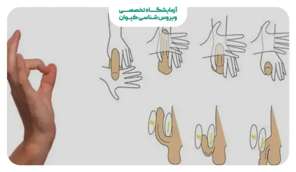  درمان کوچک بودن اندام تناسلی نوجوانان