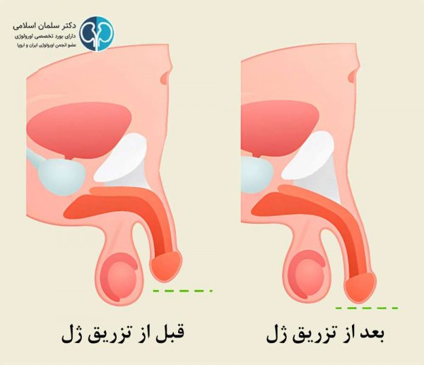  قیمت عمل جراحی دستگاه تناسلی مردان
