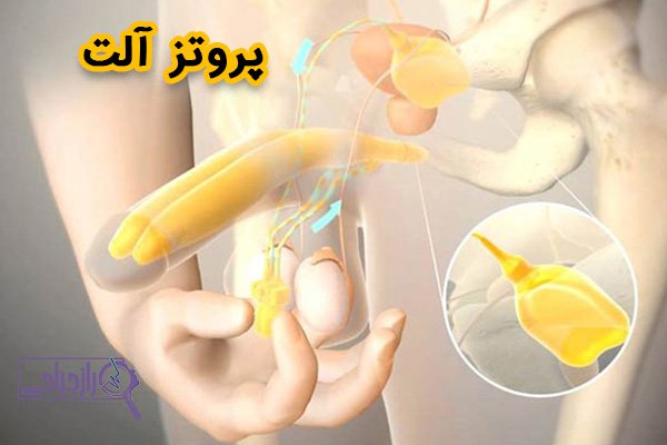  قیمت عمل جراحی دستگاه تناسلی مردان