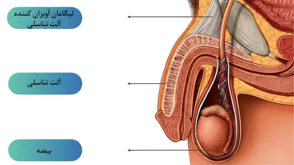  عوارض تزریق ژل به اندام تناسلی مردان+تجربه مردان از تزریق ژل به آلت