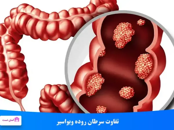  سرطان مقعدی چه علائمی دارد؟