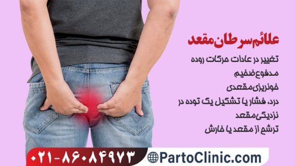  علائم سرطان بواسیر+علائم تومور مقعدی