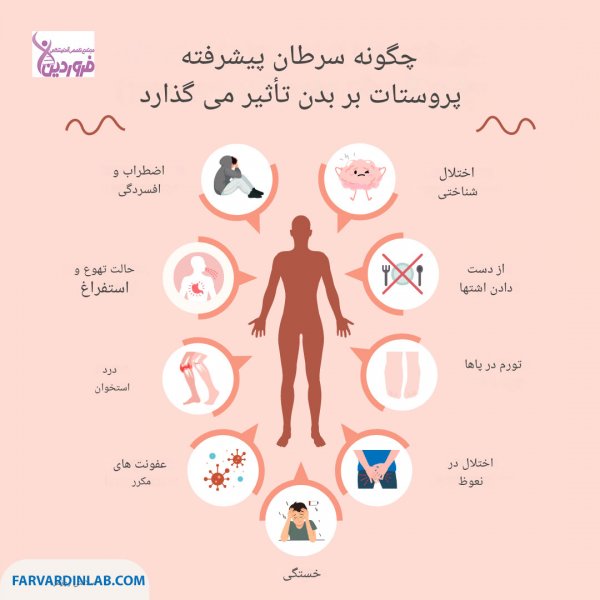  آیا رابطه جنسی زیاد باعث پروستات میشود؟