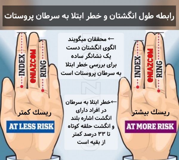  معاینه پروستات چگونه انجام میشود؟