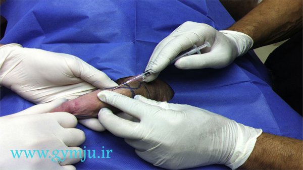  فیلم تزریق چربی به ناحیه تناسلی مردان + هزینه تزریق چربی به اندام تناسلی مردان