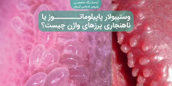 عکس وستیبولار پاپیلوماتوز + عکس پاپول مرواریدی زنانه