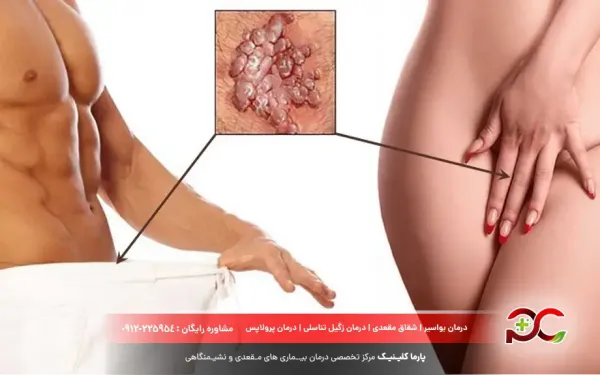  علائم پاپول مرواریدی زنانه