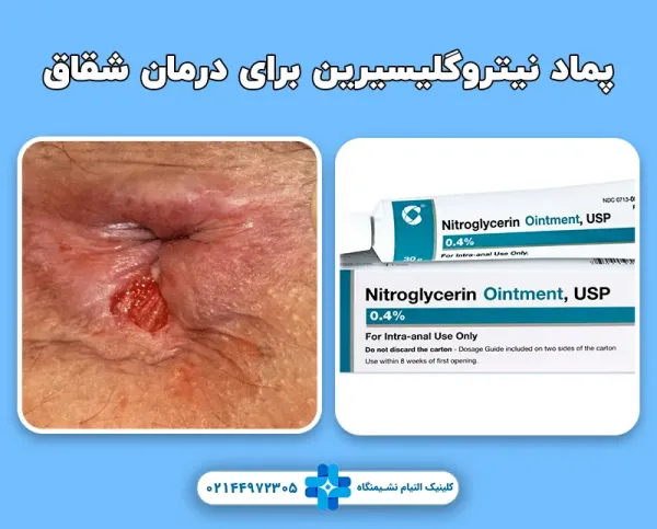  علت گشاد شدن روده بزرگ / گشاد شدن مقعد