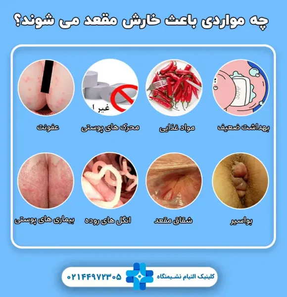  علت سوزش بعد از رابطه مقعدی / دخول از پشت