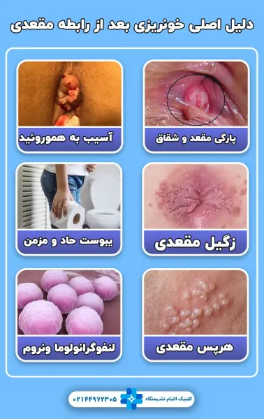  سوال و جواب درباره رابطه مقعدی/ نزدیکی از پشت