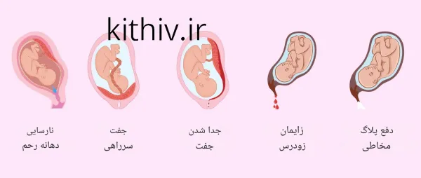  خود ارضايي در بارداري از نظر اسلام