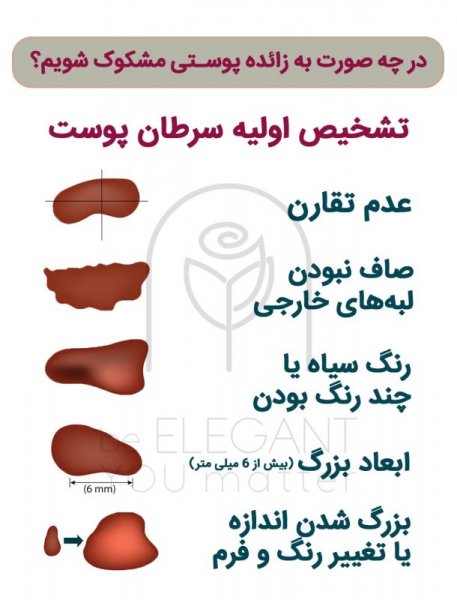  آیا منگوله پوستی / اسکین تگ خطرناک است؟