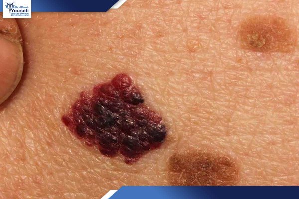  اسکین تگ ناحیه تناسلی زنان