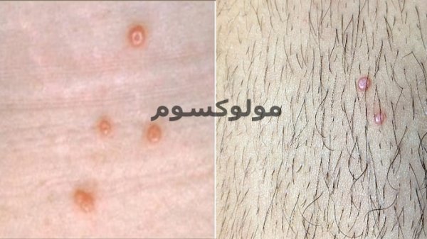  اسکین تگ ناحیه تناسلی زنان