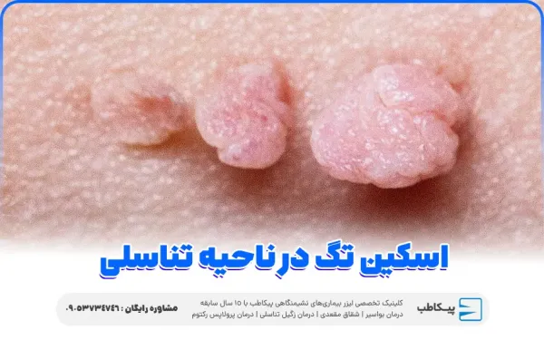  اسکین تگ ناحیه تناسلی زنان