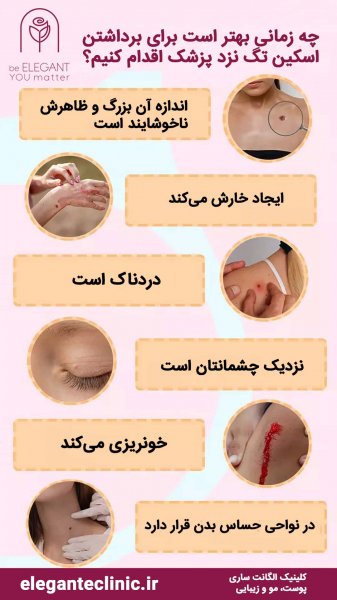  اسکین تگ ناحیه تناسلی زنان