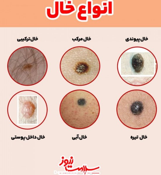  اسکین تگ ناحیه تناسلی زنان