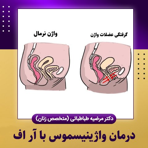  فیلم درمان واژینیسموس با آر اف