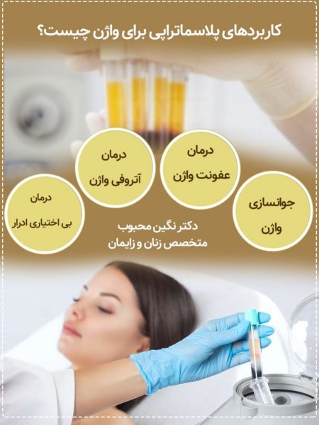  پلاسما تراپی واژن چگونه انجام میشود؟