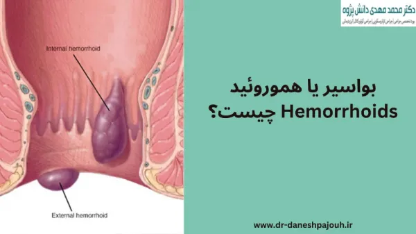 بواسیر چیست با عکس