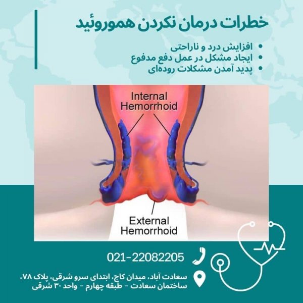  بواسیر چیست با عکس