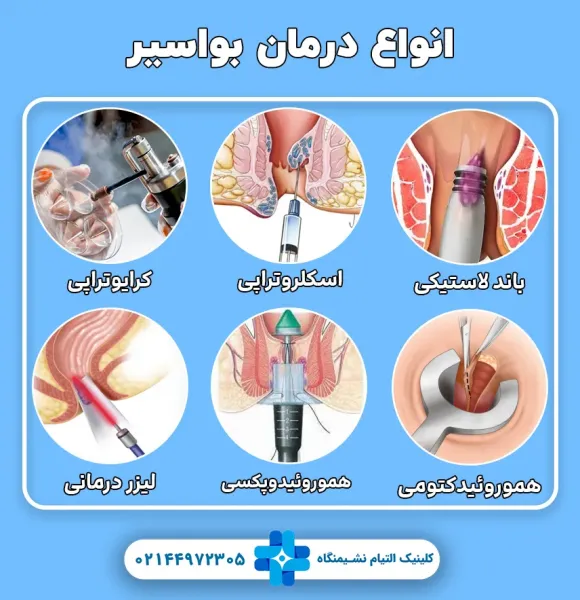  بواسیر چیست با عکس