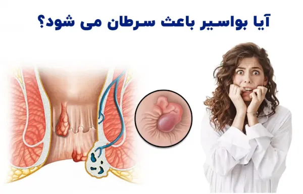 چه زمانی بواسیر خطرناک است؟