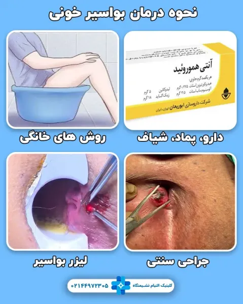  چه زمانی بواسیر خطرناک است؟