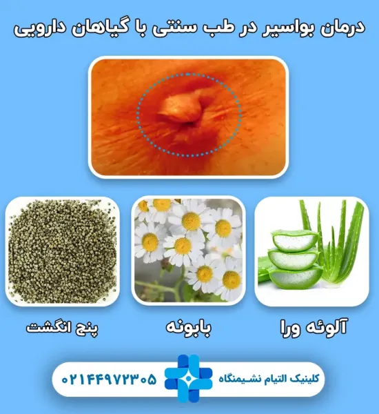  بواسیر خارجی خطرناک است یا داخلی + عکس