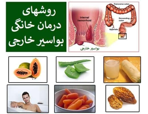  بواسیر خارجی خطرناک است یا داخلی + عکس