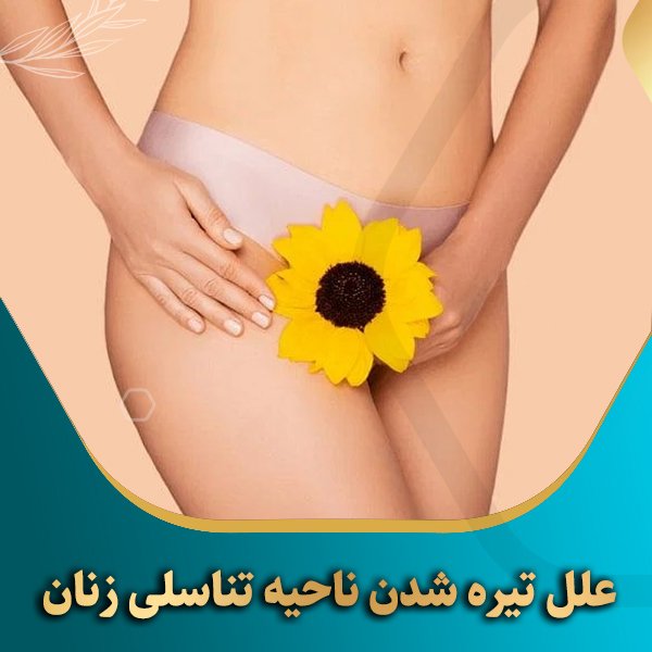 ناحیه تناسلی زنان چرا سیاه میشود؟