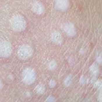  ناحیه تناسلی زنان چرا سیاه میشود؟