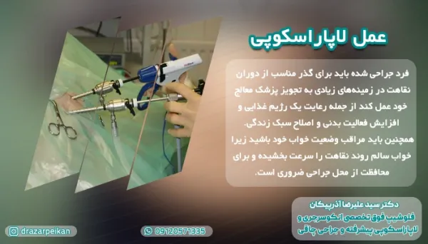  مدت زمان استراحت بعد از عمل لاپاراسکوپی رحم