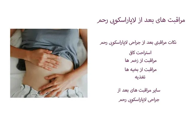 مدت زمان استراحت بعد از عمل لاپاراسکوپی رحم