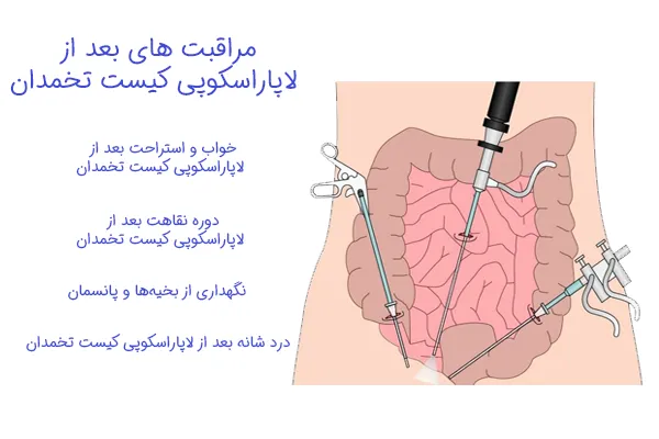  مدت زمان استراحت بعد از عمل لاپاراسکوپی رحم