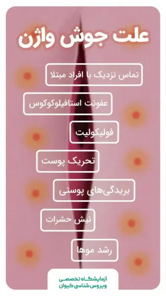  فرق زگیل مقعدی با جوش