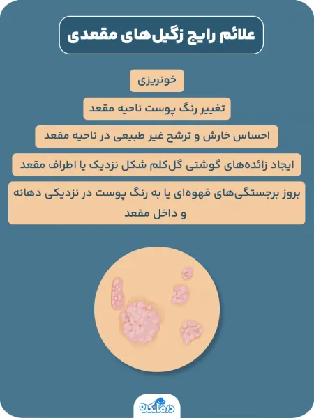  زگیل مقعدی چگونه به وجود میاد/ می آید؟