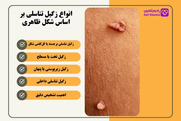  زگیل مقعدی چگونه به وجود میاد/ می آید؟