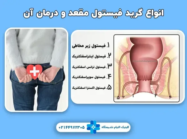  عکس عفونت مقعدی