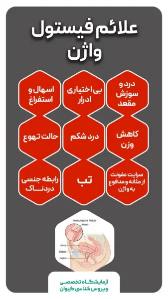  بیماری فیستول مقعدی در زنان
