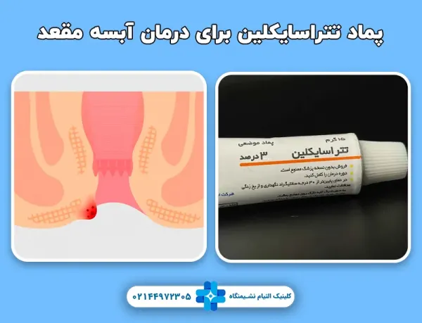  بهترین پماد برای جوش مقعدی