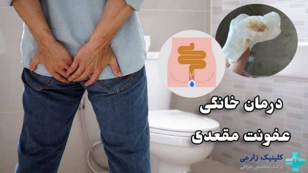 درمان عفونت مقعدی خانگی