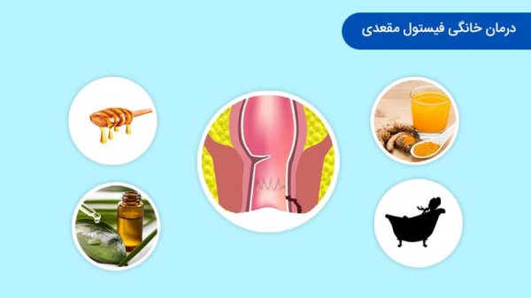  درمان عفونت مقعدی خانگی