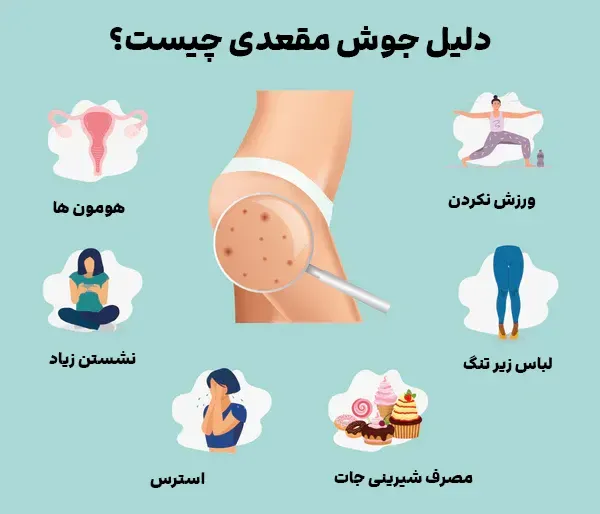  جوش داخل مقعدی نشانه چیست؟