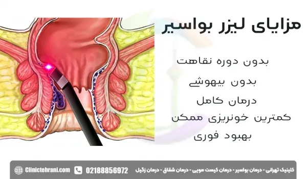  هزینه لیزر گوشت اضافه مقعدی