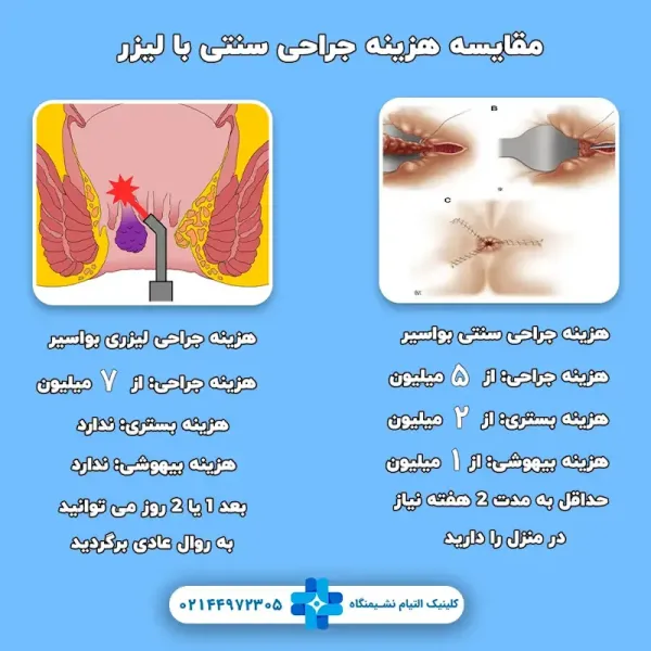  هزینه لیزر گوشت اضافه مقعدی