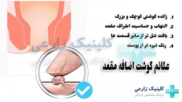  فیلم و عکس جراحی گوشت اضافه مقعدی