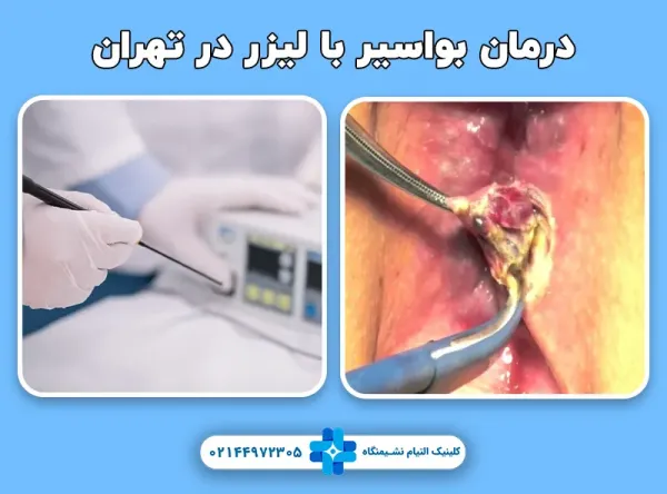  فیلم عمل بواسیر زنان با لیزر بدون سانسور